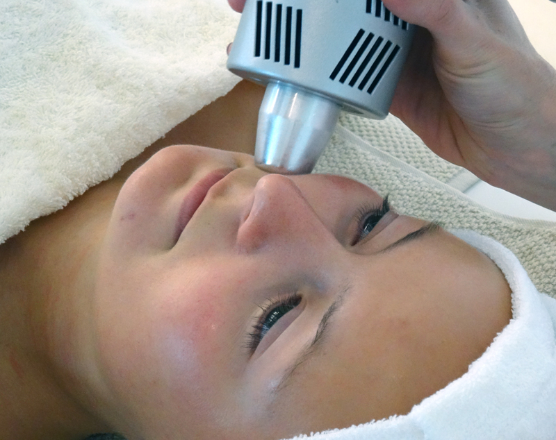 beautyblog-hr-electrosculpting-cooling